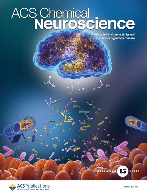 Mass Spectrometric Imaging of Anionic Phospholipids Desorbed from Human Hippocampal Sections: Discrimination between Temporal and Nontemporal Lobe Epilepsies