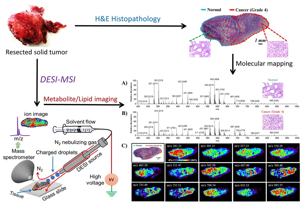 Imaging Mass Spectrometry: Spatial Omics for Precision Diagnosis